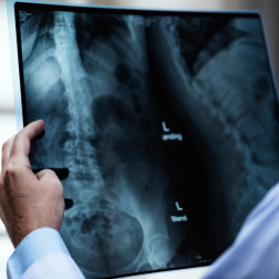 X-Ray Imaging